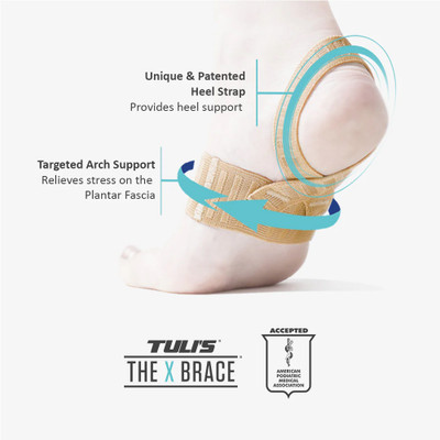 The X Brace infographic